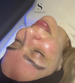 SkinSutra Med Spa